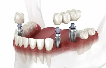 https://dl3.joxi.net/drive/2025/04/16/0058/3852/3829516/16/374133ee37.jpg